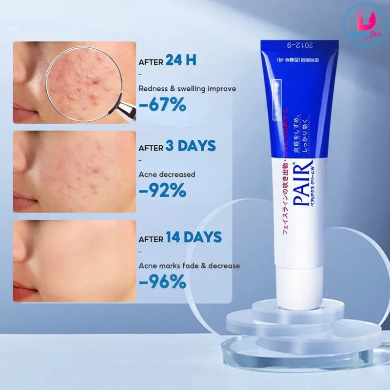 LION Pair Acne Cream [14g]